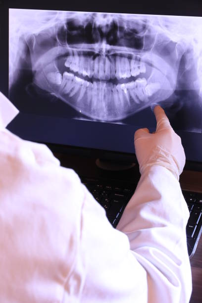 Best Emergency Wisdom Teeth Removal in Scottsbluff, NE